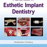 Download Advances in Esthetic Implant Dentistry PDF Free