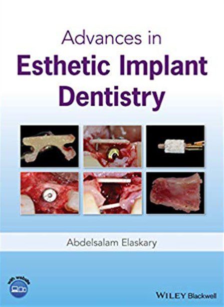 Download Advances in Esthetic Implant Dentistry PDF Free