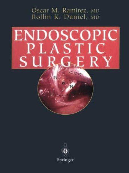 Endoscopic Plastic Surgery PDF Free Download