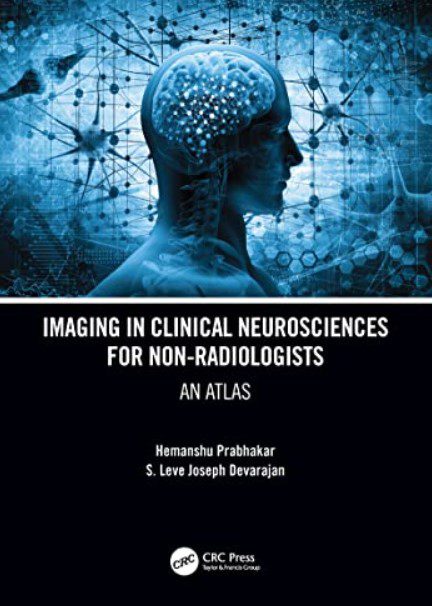 Imaging in Clinical Neurosciences for Non-radiologists: An Atlas PDF Free Download
