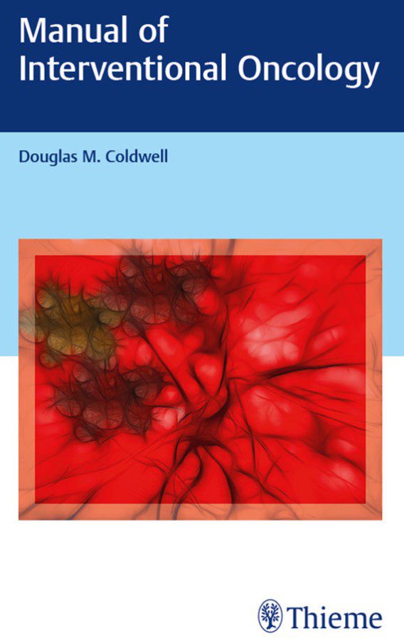 Manual of Interventional Oncology PDF Free Download
