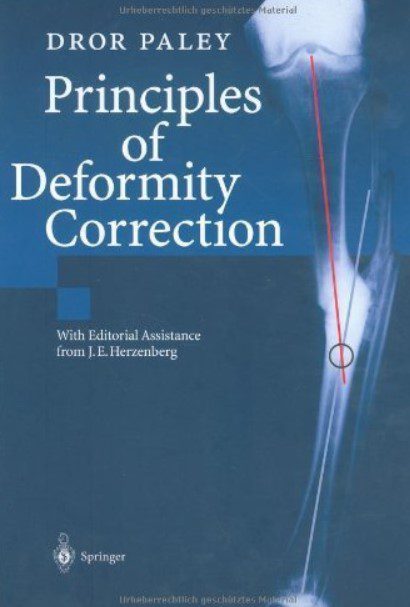 Principles of Deformity Correction PDF Free Download