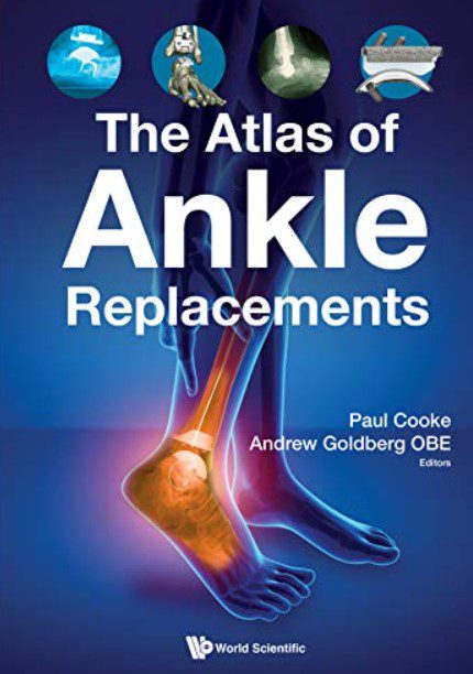 The Atlas of Ankle Replacements by Andrew J Goldberg PDF Free Download