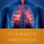 Thoracic Anesthesia Procedures by Alan Kaye PDF Free Download