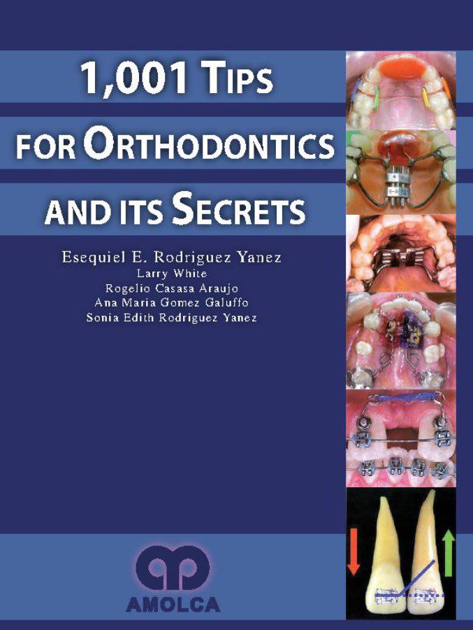 1,001 Tips for Orthodontics and Its Secrets PDF Free Download