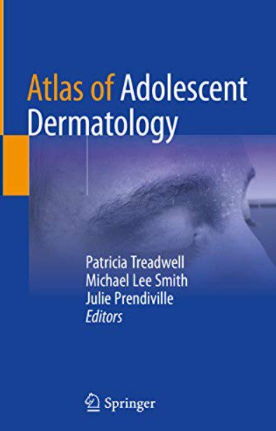 Atlas of Adolescent Dermatology by Patricia Treadwell PDF Free Download