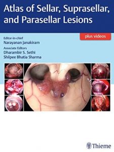 Atlas of Sellar, Suprasellar, and Parasellar Lesions PDF Free Download