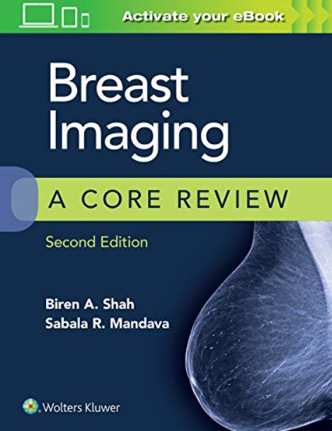 Breast Imaging: A Core Review by Biren A Shah PDF Free Download