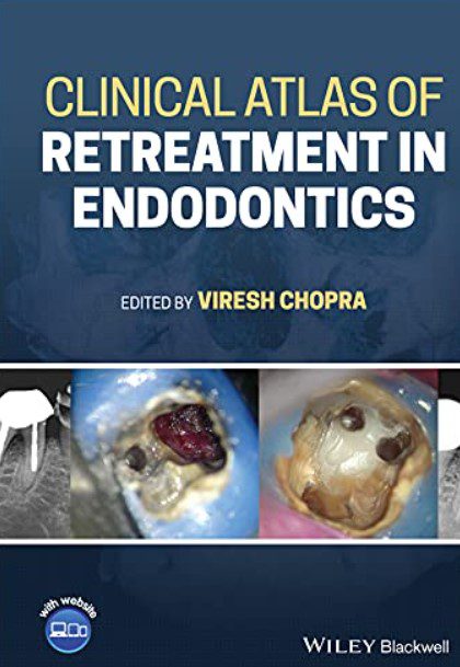 Clinical Atlas of Retreatment in Endodontics by Viresh Chopra PDF Free Download