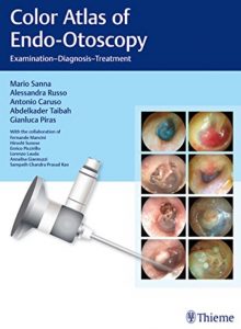 Color Atlas of Endo-Otoscopy: Examination-Diagnosis-Treatment PDF Free Download
