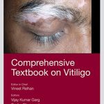 Comprehensive Textbook on Vitiligo by Vineet Relhan PDF Free Download
