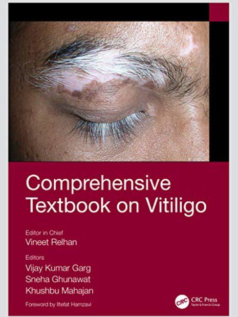 Comprehensive Textbook on Vitiligo by Vineet Relhan PDF Free Download