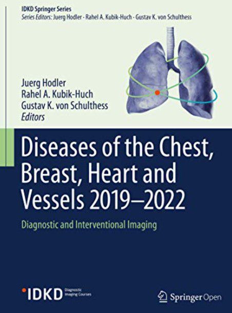 Diseases of the Chest, Breast, Heart and Vessels 2019-2022 PDF Free Download