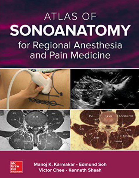 Download Atlas of Sonoanatomy for Regional Anesthesia and Pain Medicine PDF Free