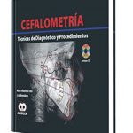 Download Cefalometría. Técnicas de diagnóstico y procedimientos (Spanish Edition) PDF Free