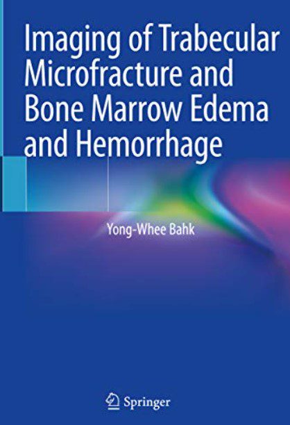 Download Imaging of Trabecular Microfracture and Bone Marrow Edema and Hemorrhage PDF Free