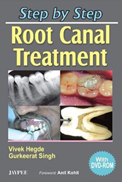 Download Step by Step Root Canal Treatment PDF Free