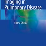 Handbook of Imaging in Pulmonary Disease PDF Free Download