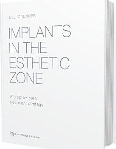 Implants in the Esthetic Zone: A Step-by-Step Treatment Strategy PDF Free Download