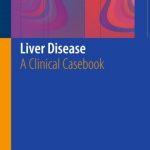 Liver Disease: A Clinical Casebook PDF Free Download
