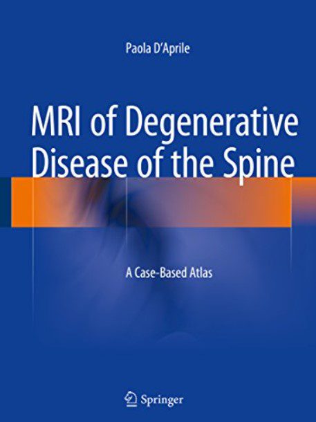 MRI of Degenerative Disease of the Spine: A Case-Based Atlas PDF Free Download
