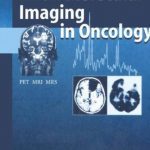 Molecular Imaging in Oncology: PET, MRI, and MRS PDF Free Download