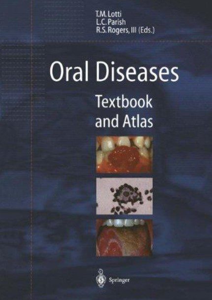 Oral Diseases: Textbook and Atlas PDF Free Download