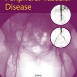 Pharmacological Therapies for Peripheral Vascular Disease PDF Free Download