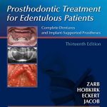 Prosthodontic Treatment for Edentulous Patients 13th Edition PDF Free Download