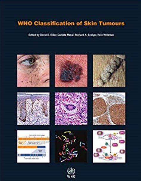 WHO Classification of Skin Tumours 4th Edition PDF Free Download