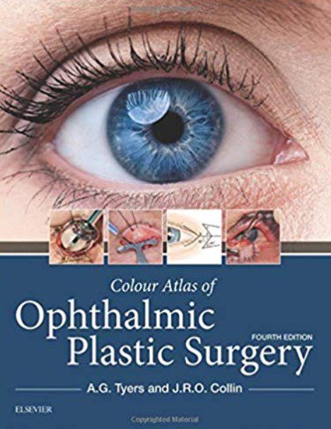 Colour Atlas of Ophthalmic Plastic Surgery 4th Edition PDF Free Download