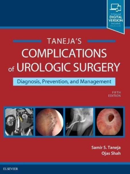 Complications of Urologic Surgery 5th Edition PDF Free Download