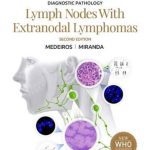 Download Diagnostic Pathology: Lymph Nodes and Extranodal Lymphomas 2nd Edition PDF Free