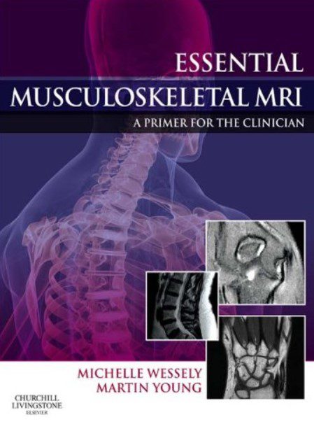 Essential Musculoskeletal MRI E-Book: A Primer for the Clinician PDF Free Download
