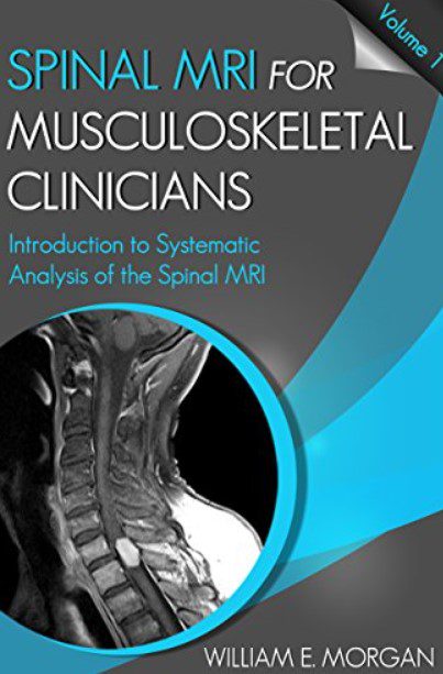 Introduction to Systematic Analysis of the Spinal MRI PDF Free Download