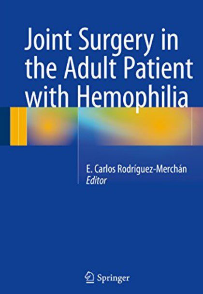 Joint Surgery in the Adult Patient with Hemophilia PDF Free Download