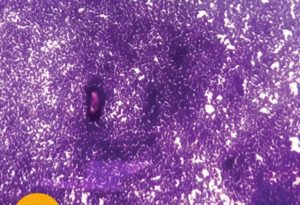 Masters of Pathology : Cytopathology 2022 Videos Free Download