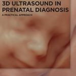 3D Ultrasound in Prenatal Diagnosis: A Practical Approach PDF Free Download