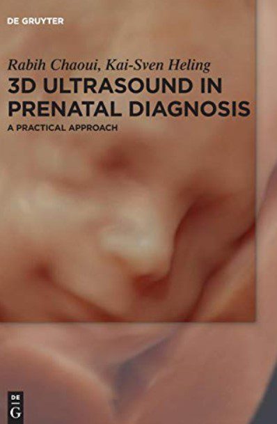 3D Ultrasound in Prenatal Diagnosis: A Practical Approach PDF Free Download
