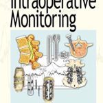 A Concise Guide to Intraoperative Monitoring PDF Free Download