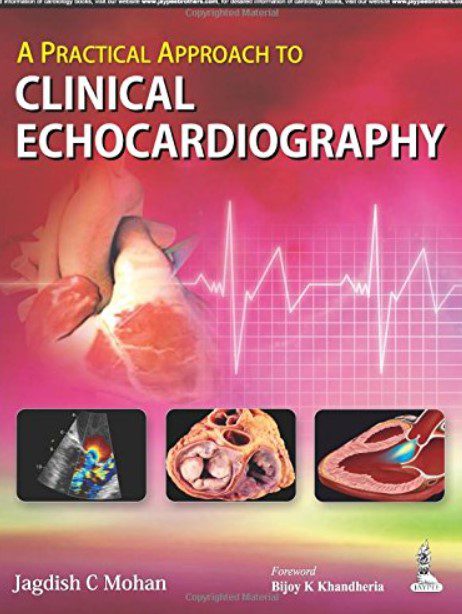 A Practical Approach to Clinical Echocardiography PDF Free Download