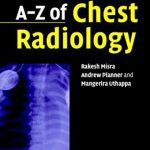 A-Z of Chest Radiology By Andrew Planner PDF Free Download