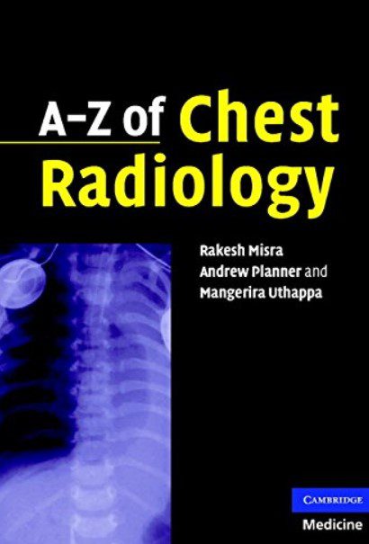 A-Z of Chest Radiology By Andrew Planner PDF Free Download