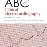 ABC of clinical electrocardiography By Francis Morris PDF Free Download