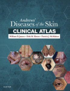 Andrews’ Diseases of the Skin Clinical Atlas PDF Free Download