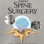 Imaging in Spine Surgery PDF Free Download