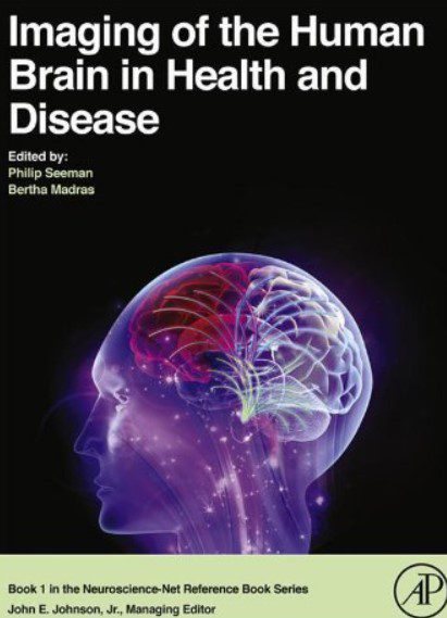 Imaging of the Human Brain in Health and Disease PDF Free Download