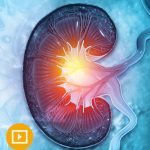 Oakstone Intensive Review of Nephrology 2022 Videos Free Download