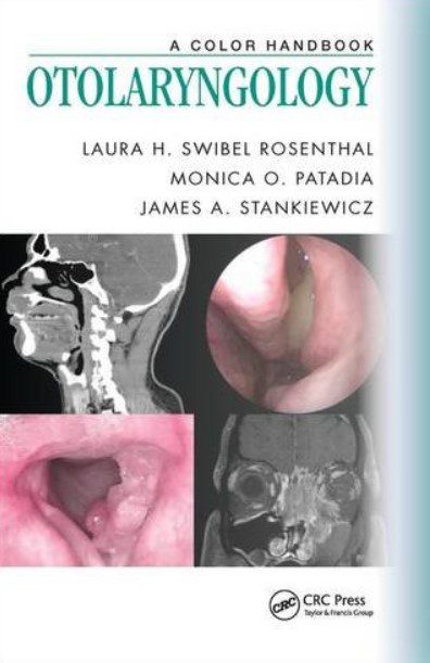 Otolaryngology A Color Handbook PDF Free Download
