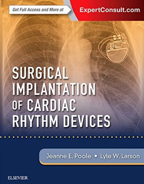 Surgical Implantation of Cardiac Rhythm Devices PDF Free Download
